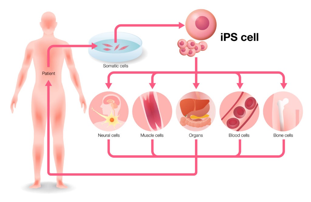 iPS細胞とは？- 歴史や実用化を簡単にわかりやすく解説 -